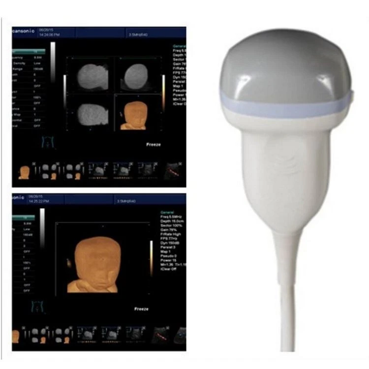 Ultrasound Probe Ultrasound Transducer Ultrasound Probe Ultrasound Transducer