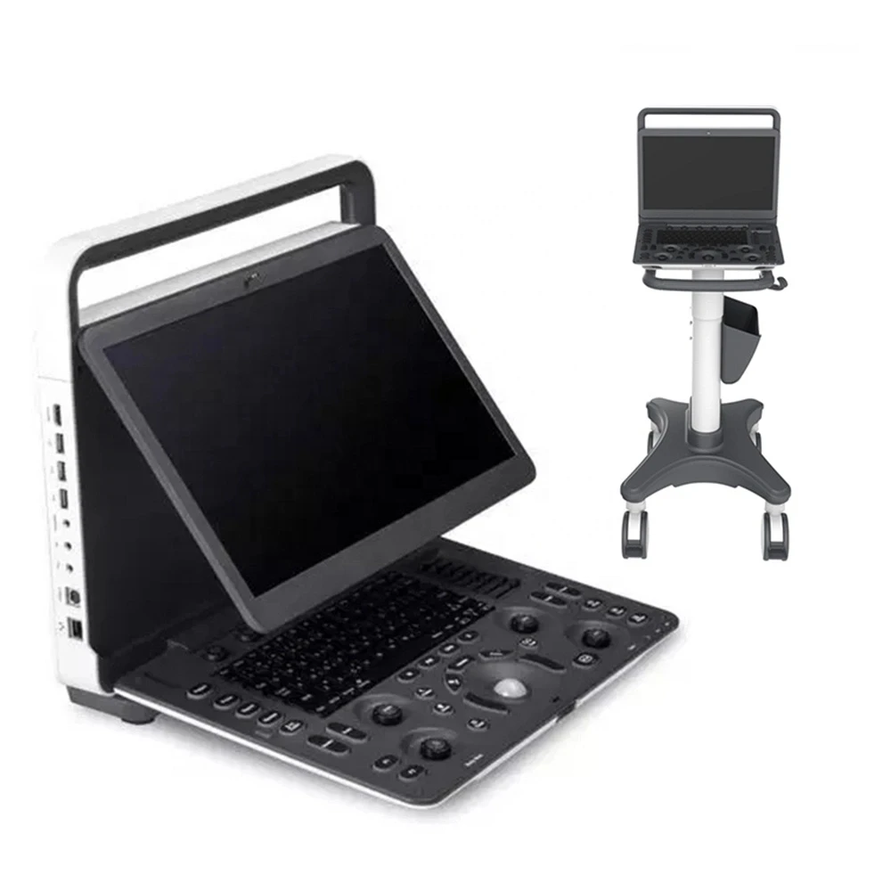 portable ultrasound portable ultrasound
