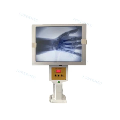 Mini C Arm X Ray
