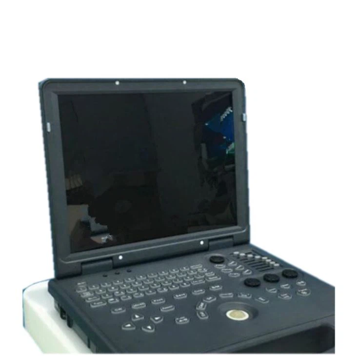 15'' LED Notebook Color Ultrasound Scanner