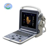 4D Baby Bærbar Medisinsk Farge Doppler Ultralyd Maskin
