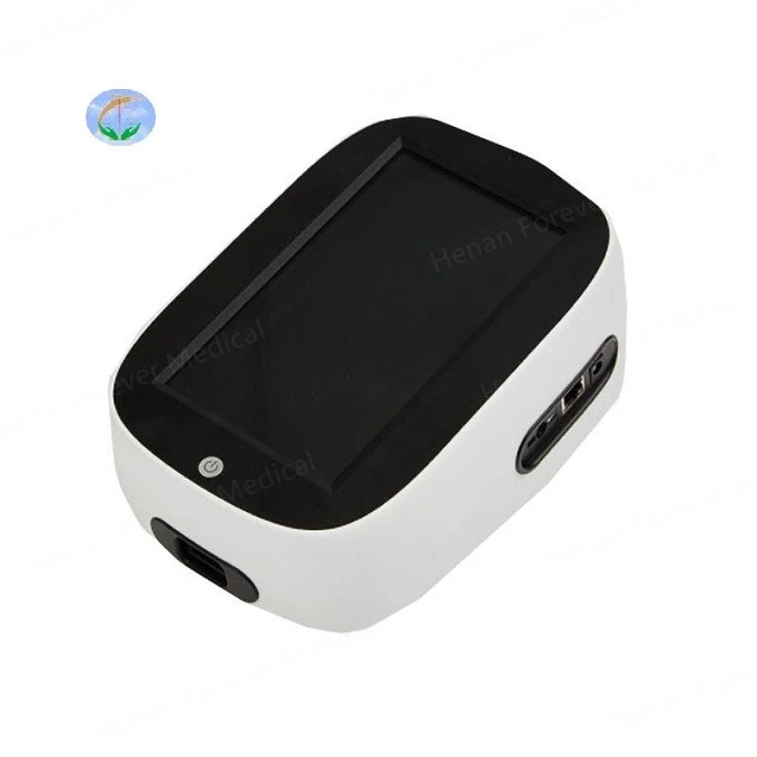 Dry Fluorescence Immunoassay Analyzer Dry Fluorescence Immunoassay Analyzer