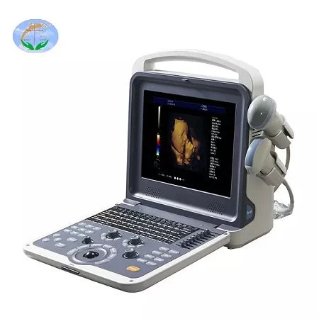 ultrasound with convex probe