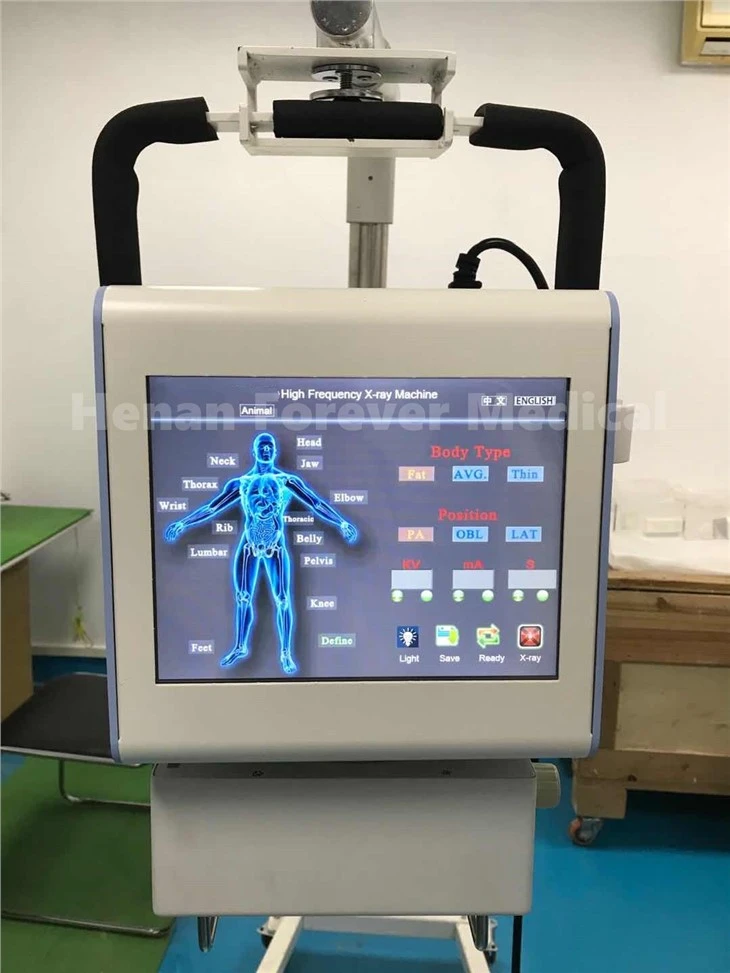 5kW Digital Portable X-ray Machine YJ-X050-C 5kW Digital Portable X-ray Machine YJ-X050-C